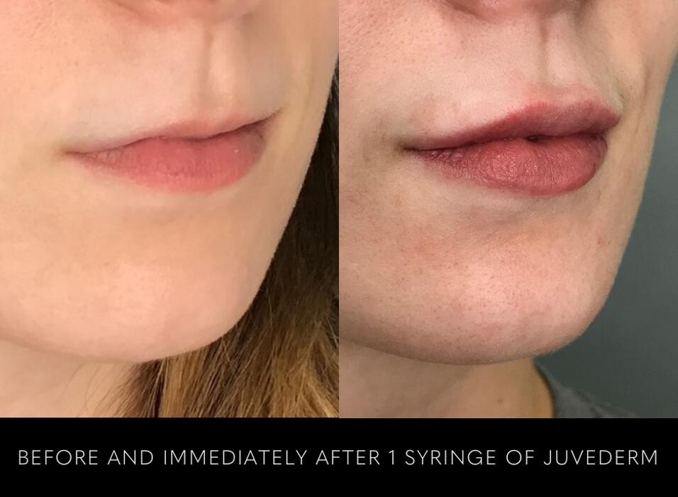 Images SLK Aesthetic Medicine