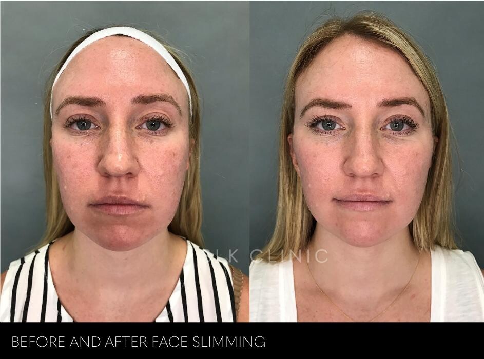 Images SLK Aesthetic Medicine