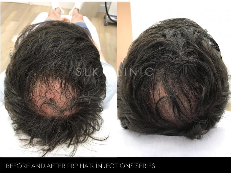 Images SLK Aesthetic Medicine