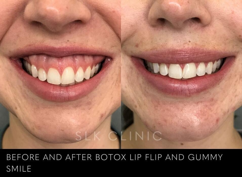 Images SLK Aesthetic Medicine