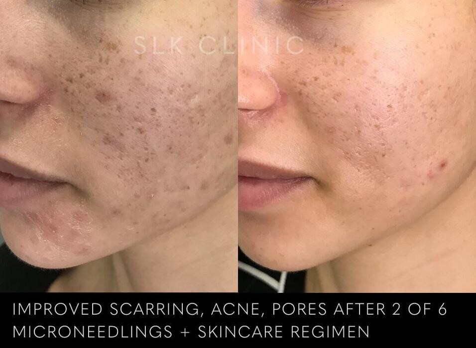 Images SLK Aesthetic Medicine