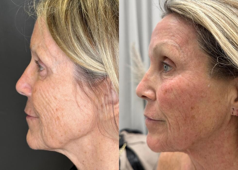 Images SLK Aesthetic Medicine