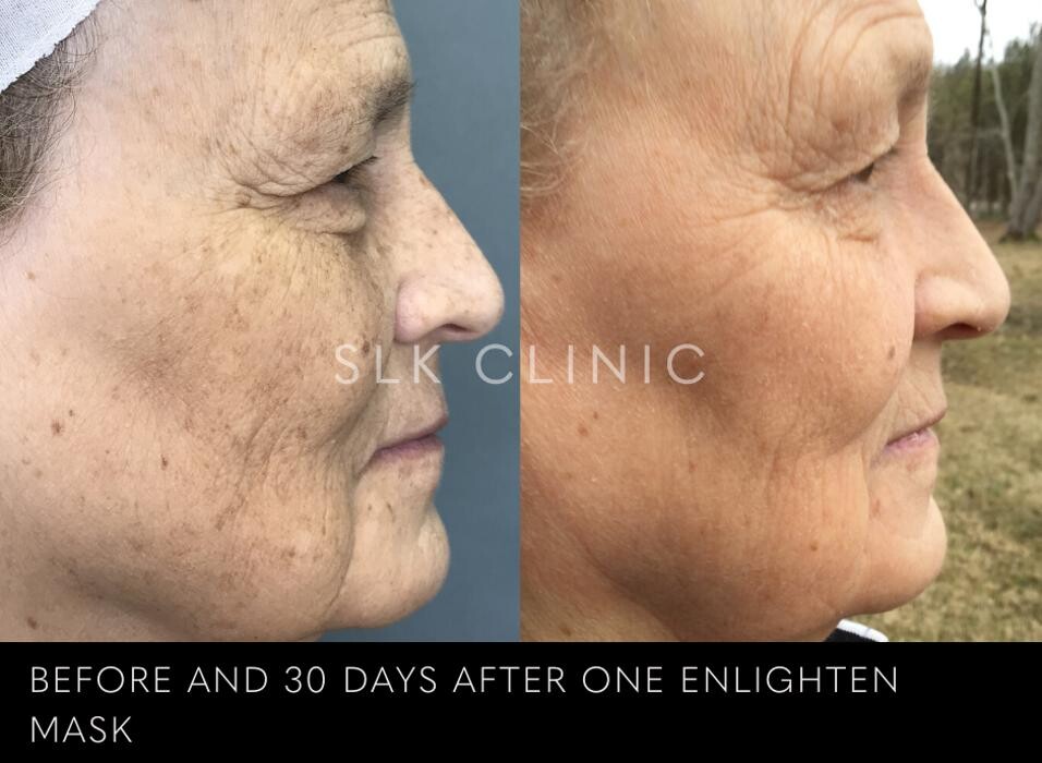 Images SLK Aesthetic Medicine