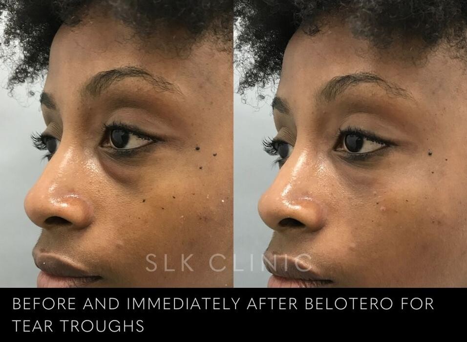 Images SLK Aesthetic Medicine