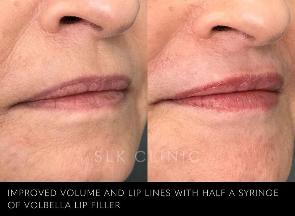 Images SLK Aesthetic Medicine