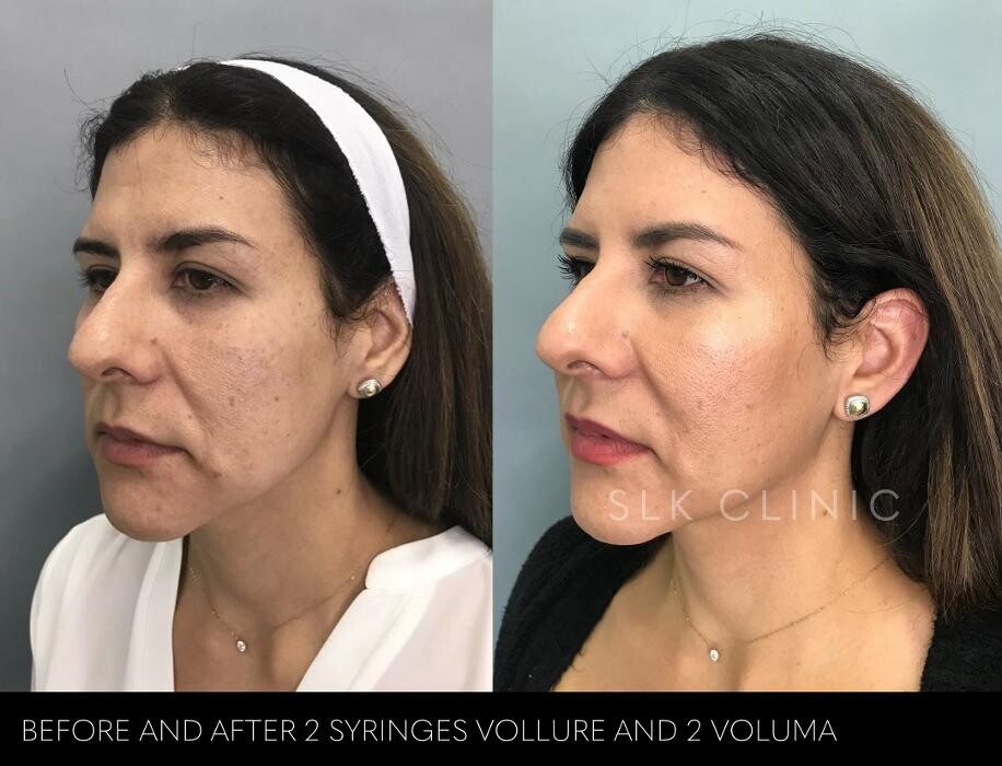 Images SLK Aesthetic Medicine