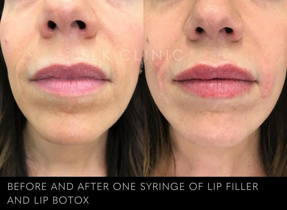 Images SLK Aesthetic Medicine