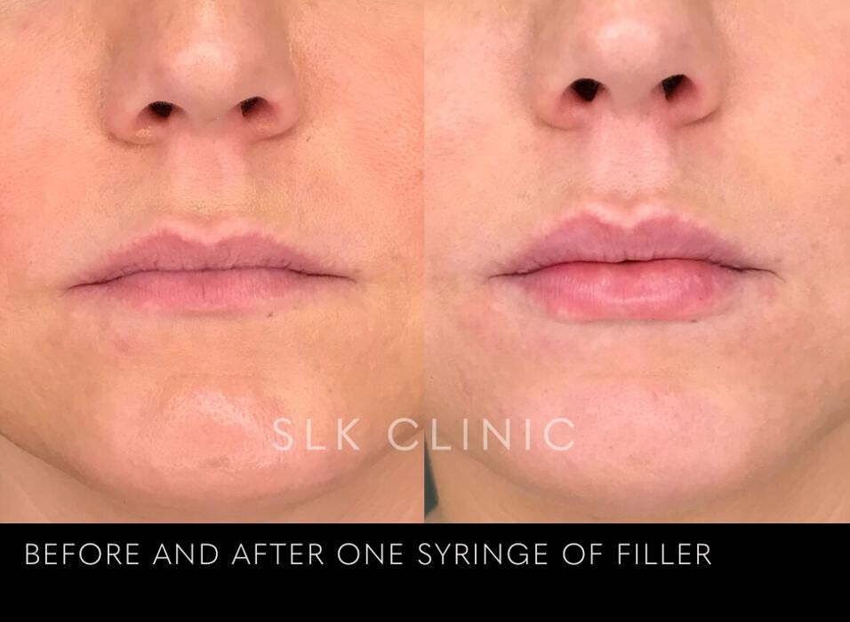 Images SLK Aesthetic Medicine