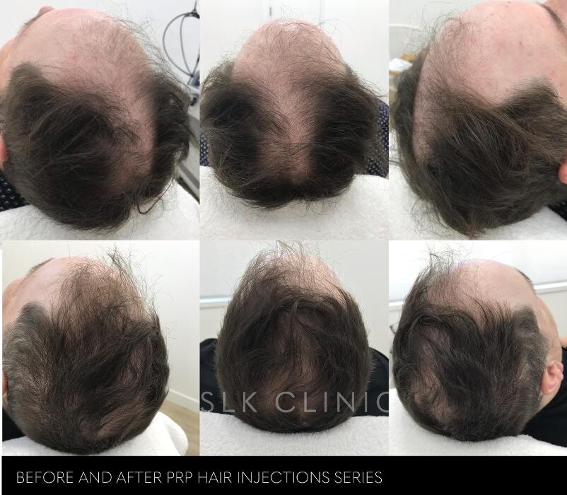 Images SLK Aesthetic Medicine