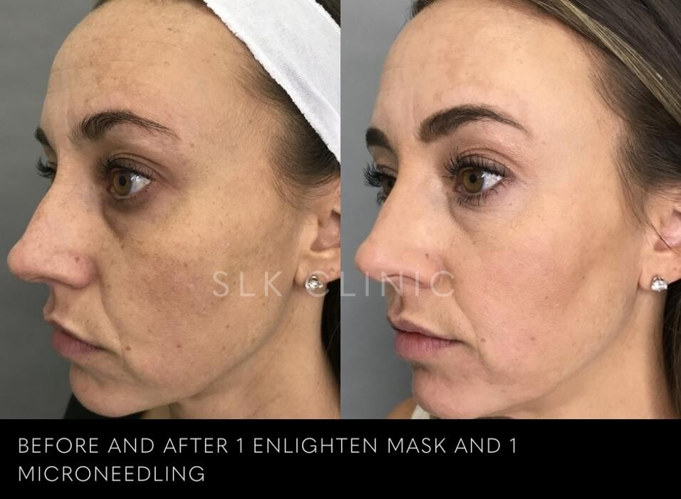 Images SLK Aesthetic Medicine