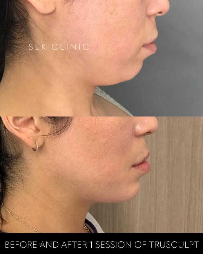 Images SLK Aesthetic Medicine