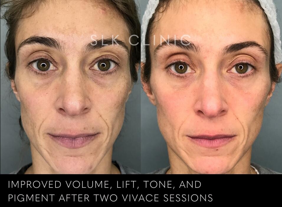 Images SLK Aesthetic Medicine