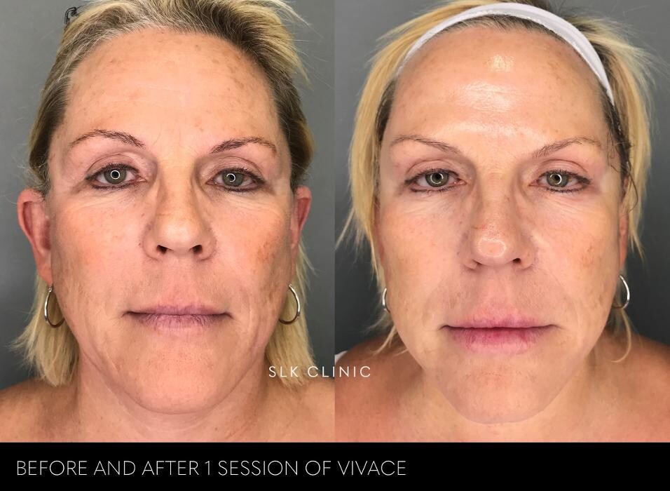 Images SLK Aesthetic Medicine