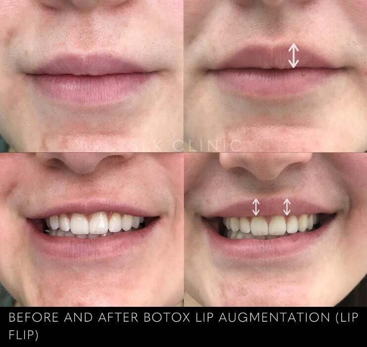 Images SLK Aesthetic Medicine