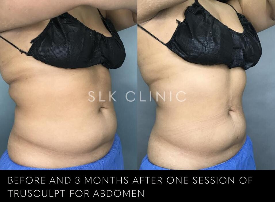 Images SLK Aesthetic Medicine