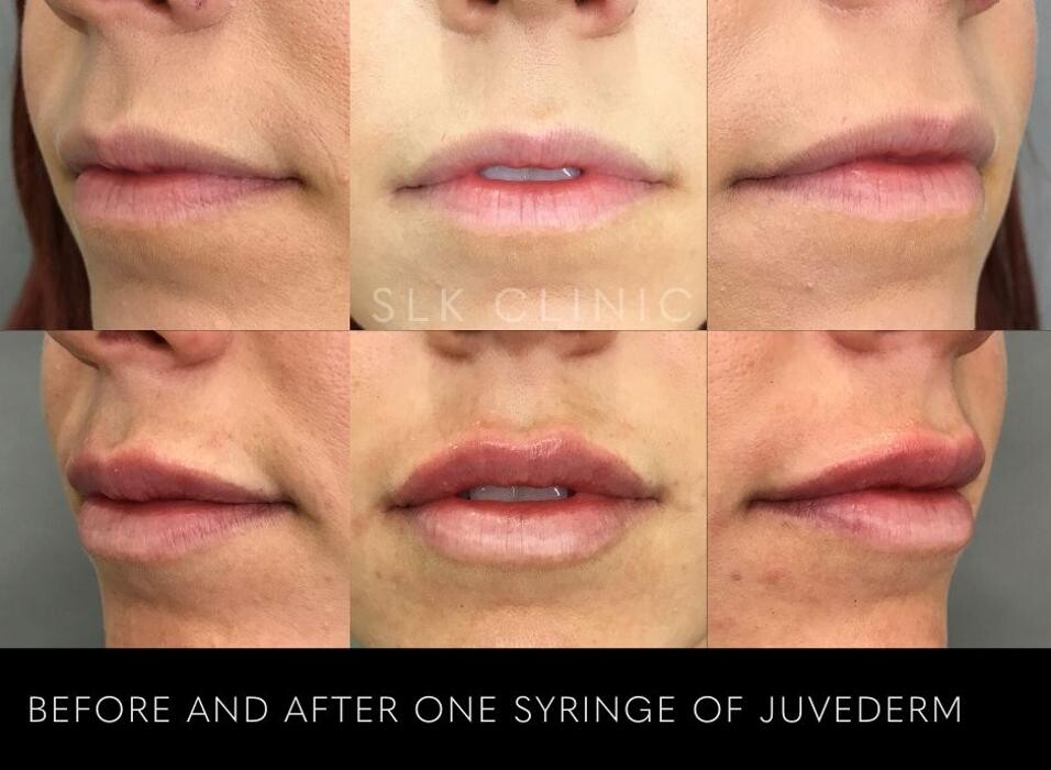 Images SLK Aesthetic Medicine