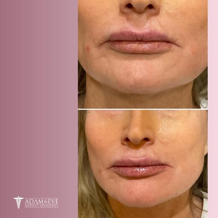 Images Adam & Eve Medical Aesthetics