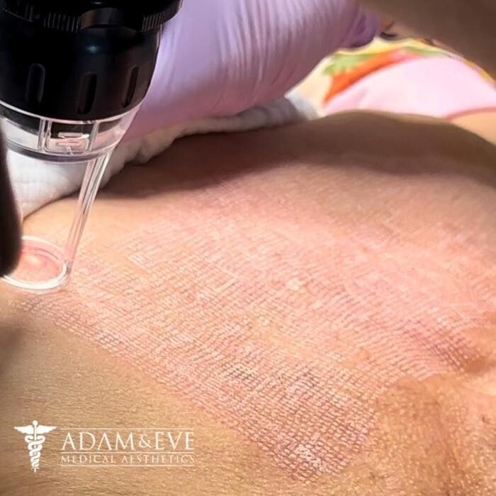 Images Adam & Eve Medical Aesthetics