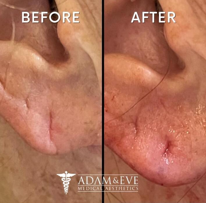 Images Adam & Eve Medical Aesthetics