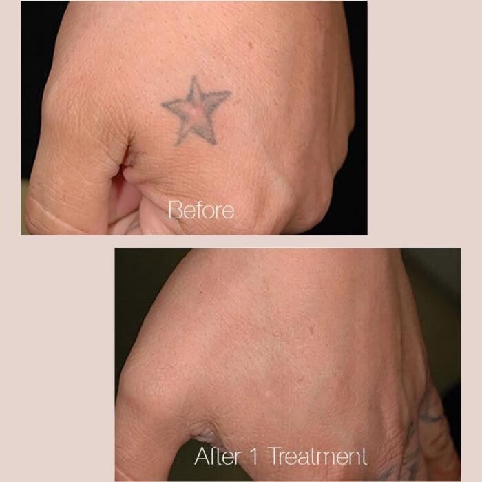 Images Adam & Eve Medical Aesthetics