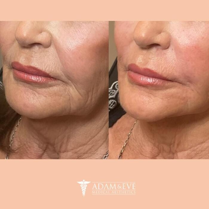 Images Adam & Eve Medical Aesthetics