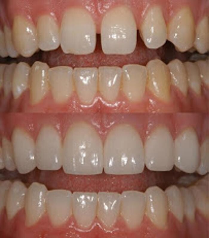 Images Advanced Dental Care of Allen