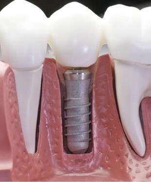 Images Advantage Dental & Dentures
