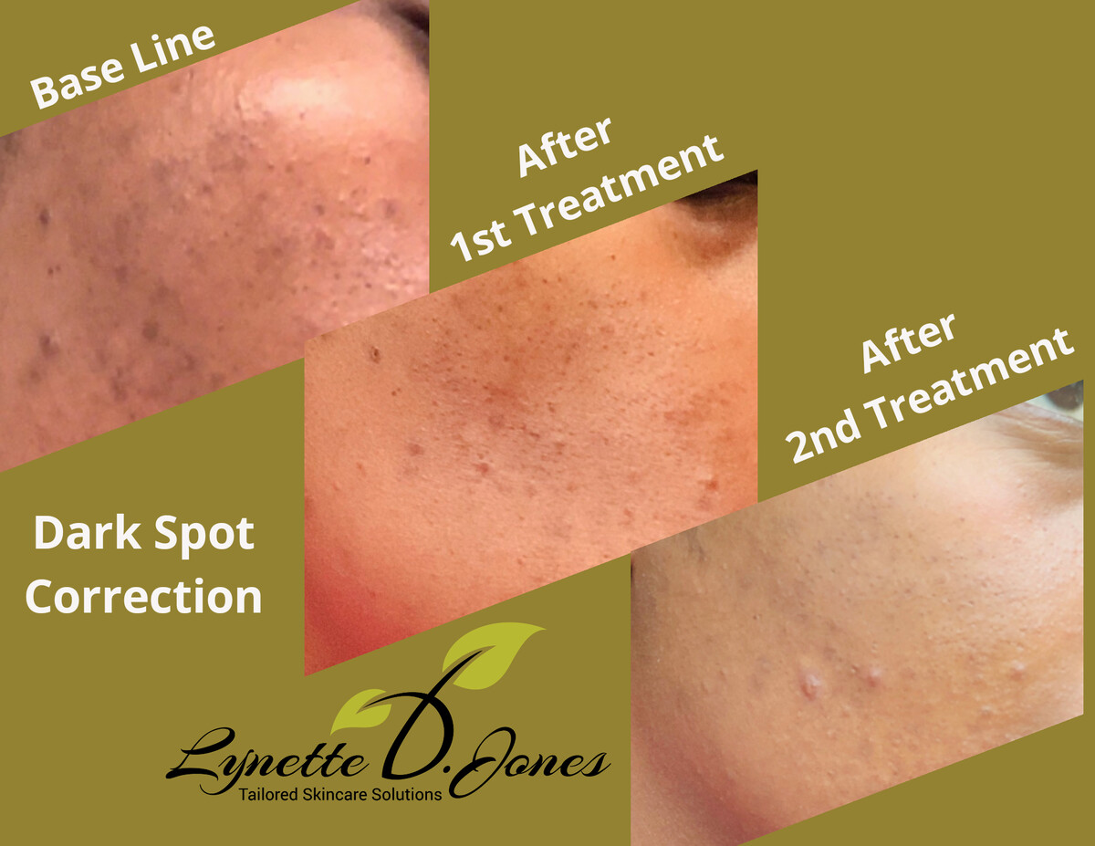 Images Lynette D. Jones Esthetics Inc.