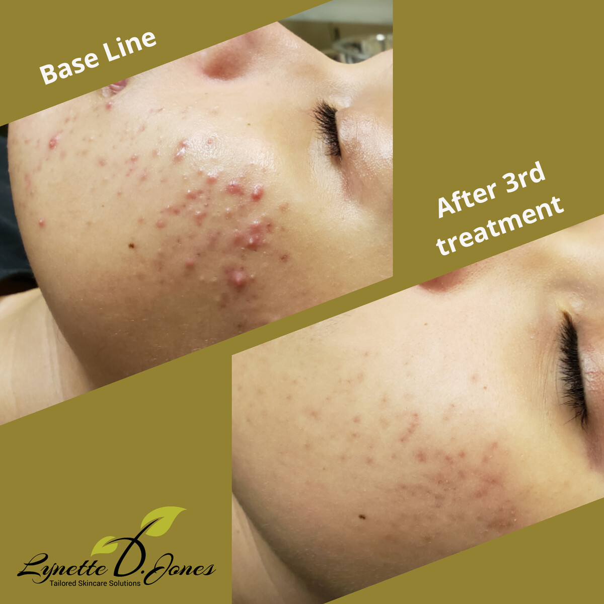 Images Lynette D. Jones Esthetics Inc.