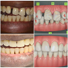 Images NY Center for Esthetic And Laser Dentistry