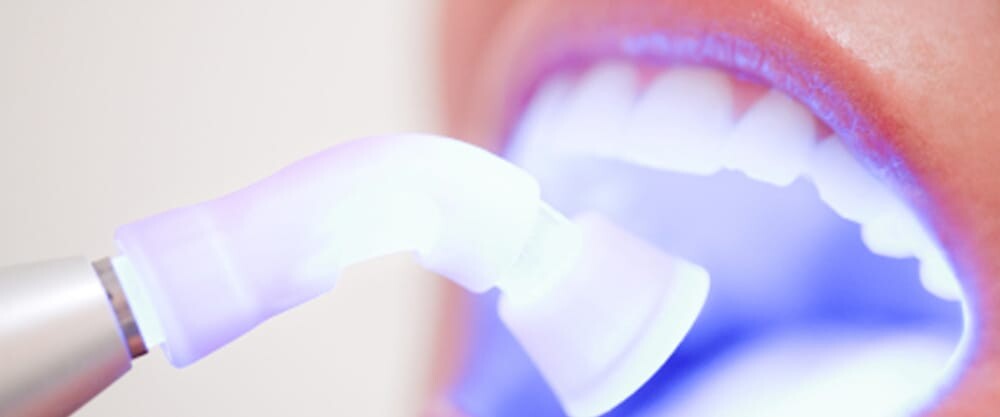 Images Broadway Family Dentistry