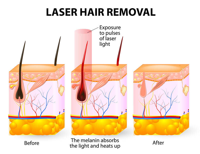 Images Gentle Touch Hair Removal Inc.