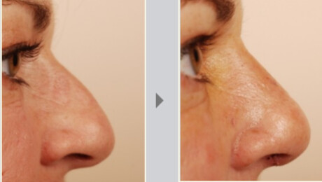 Images Pacific Heights Plastic Surgery