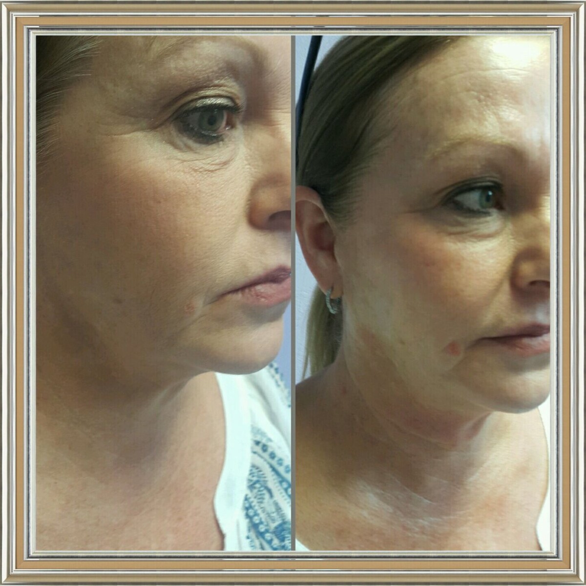 Images Anti Aging Center of Boca