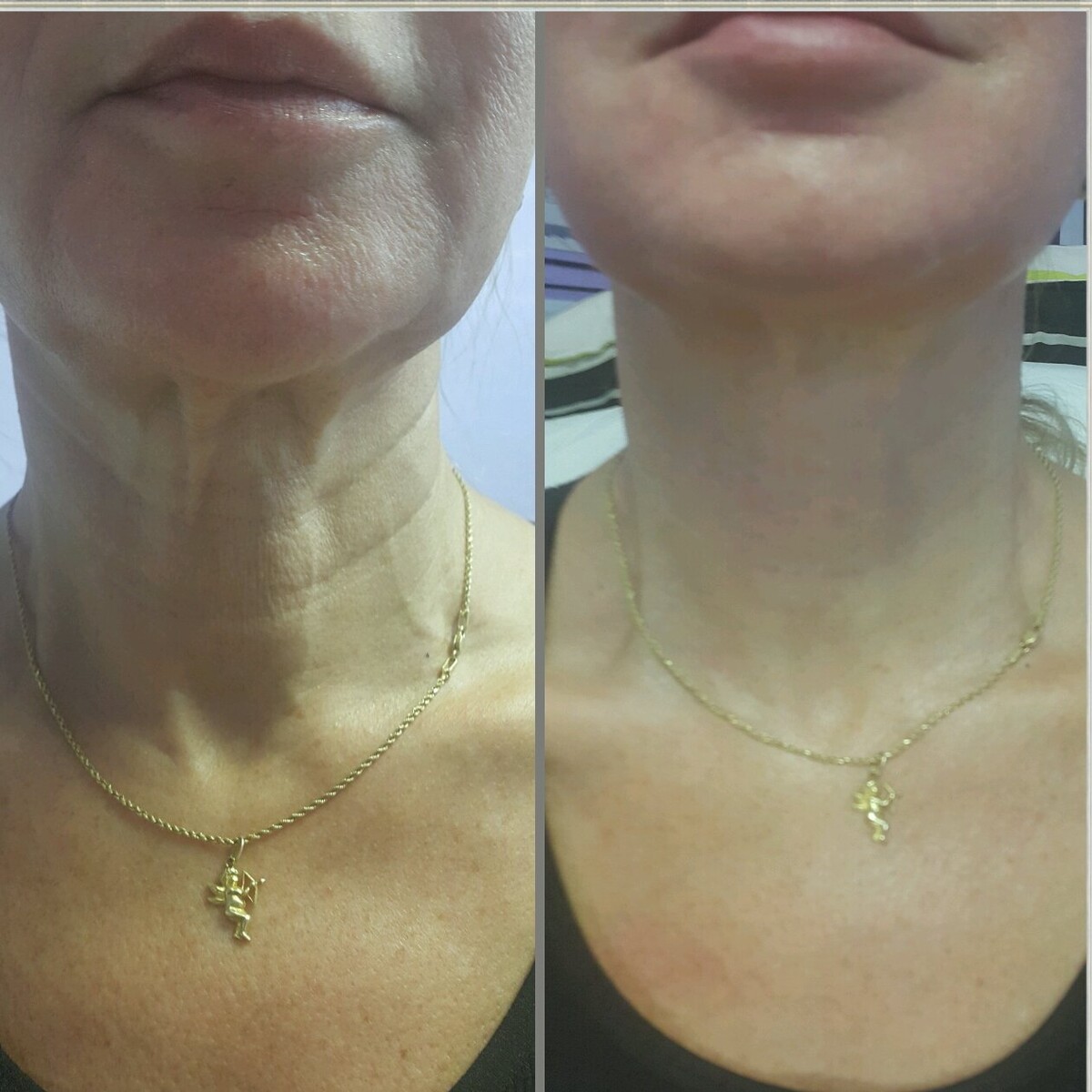 Images Anti Aging Center of Boca