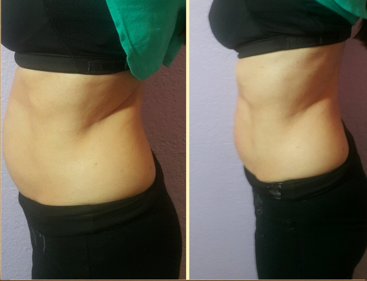 Images Anti Aging Center of Boca