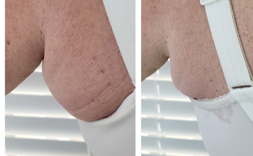 Images Anti Aging Center of Boca