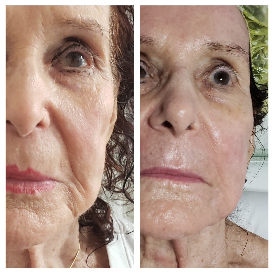 Images Anti Aging Center of Boca