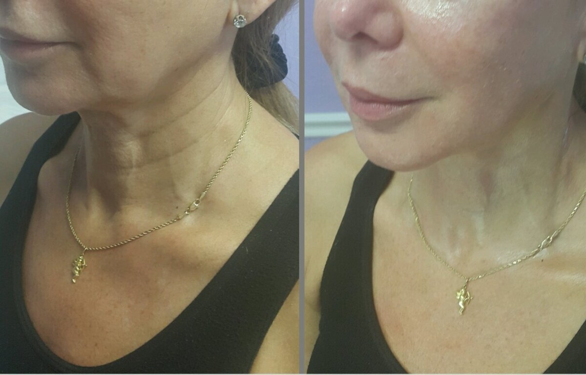 Images Anti Aging Center of Boca