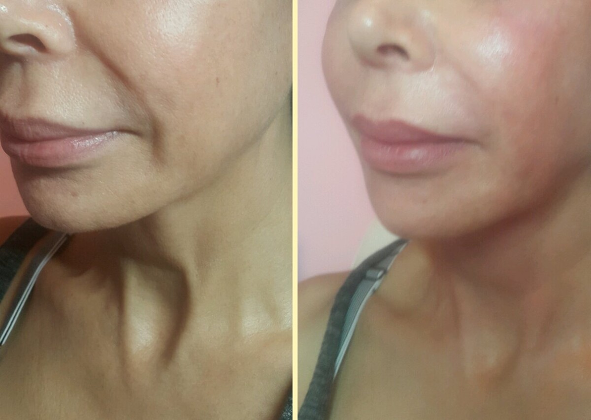 Images Anti Aging Center of Boca