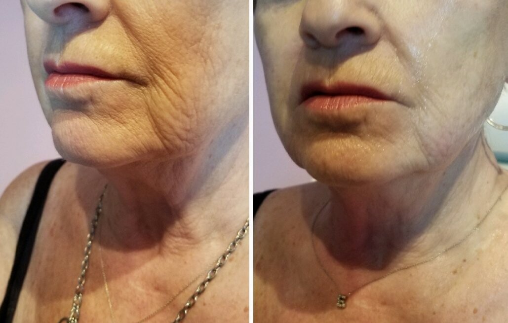 Images Anti Aging Center of Boca