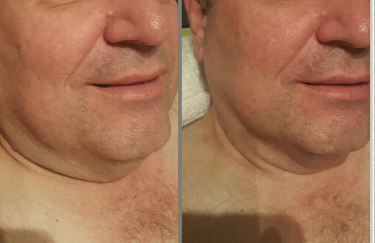 Images Anti Aging Center of Boca