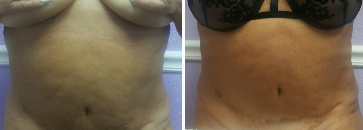 Images Anti Aging Center of Boca