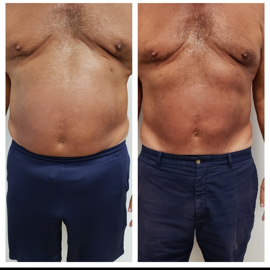 Images Anti Aging Center of Boca