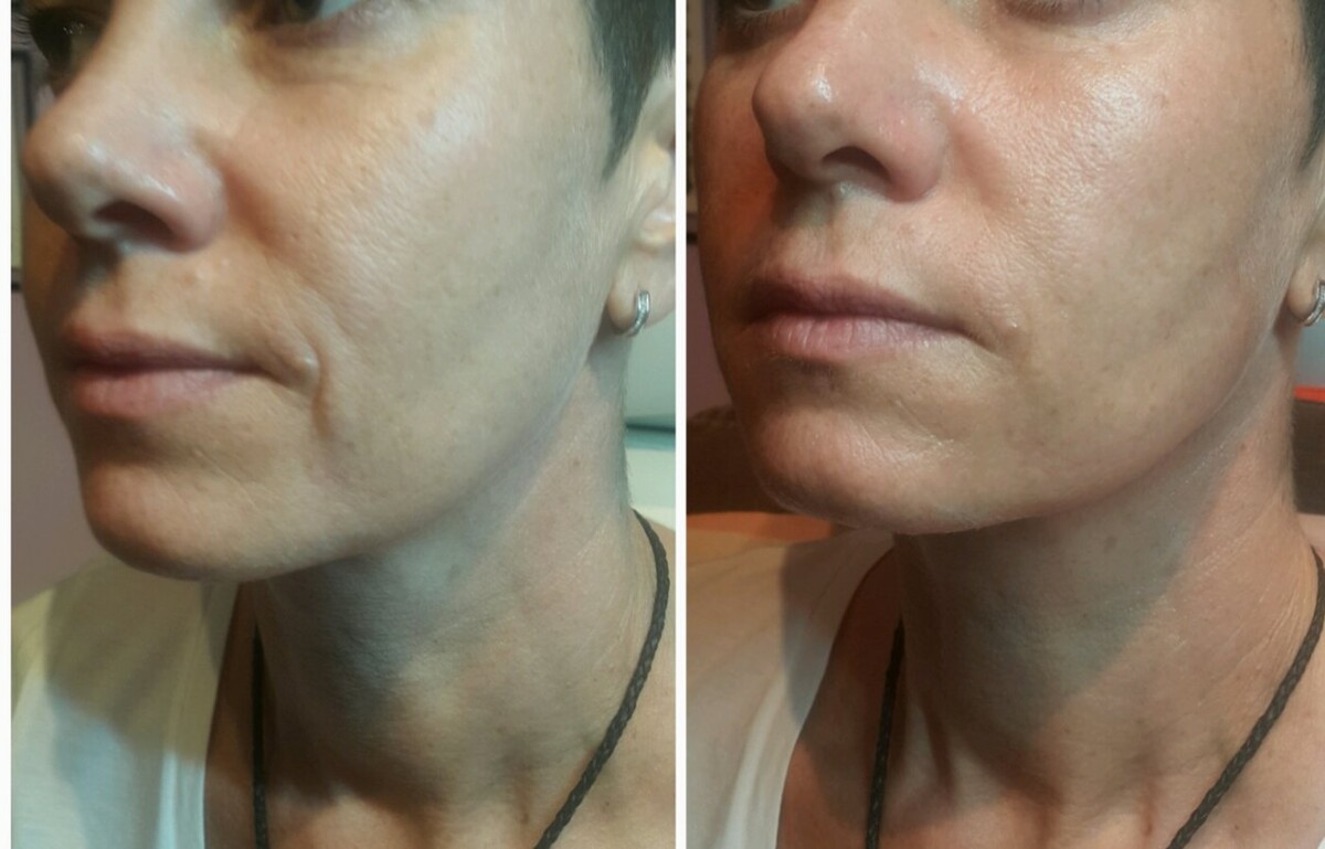 Images Anti Aging Center of Boca