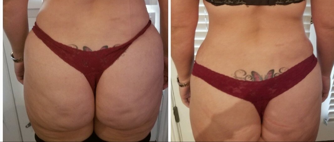Images Anti Aging Center of Boca