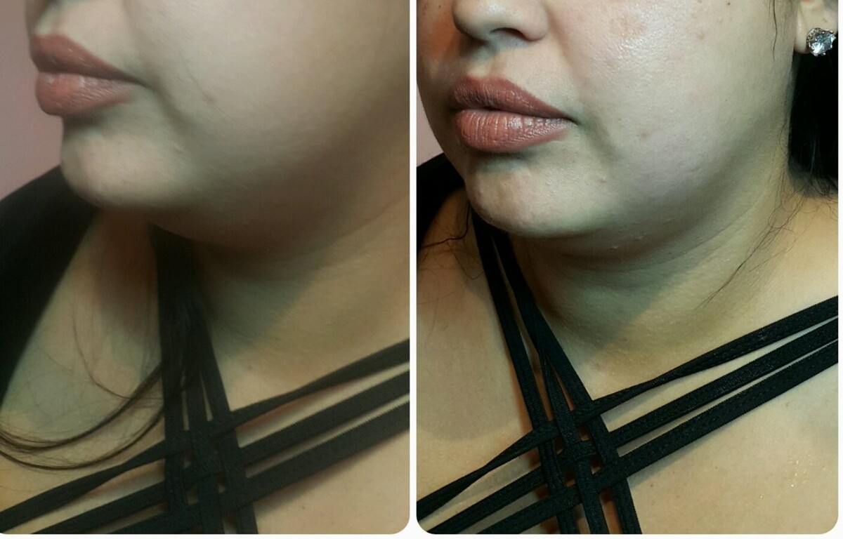 Images Anti Aging Center of Boca