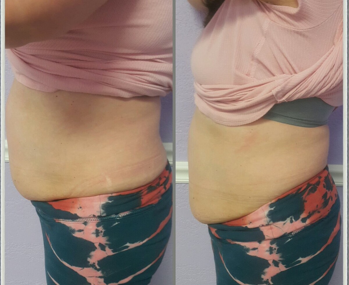 Images Anti Aging Center of Boca