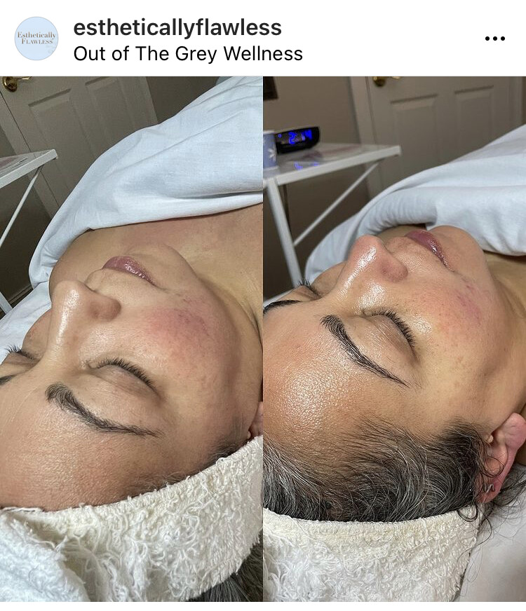 Images Out of the Grey Wellness