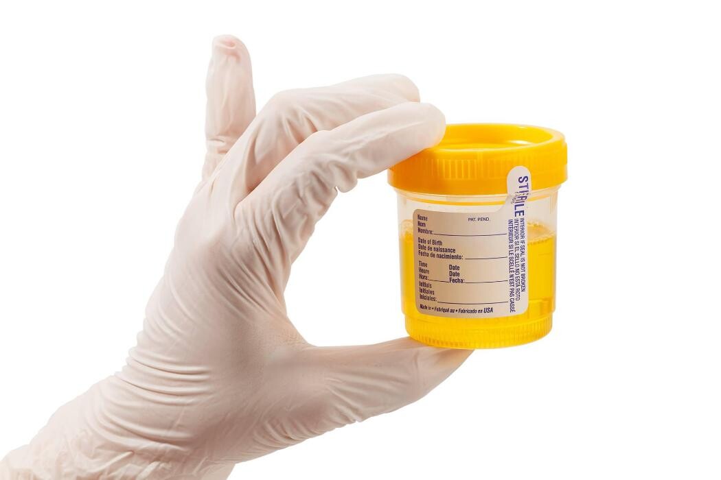 Images Drug Testing